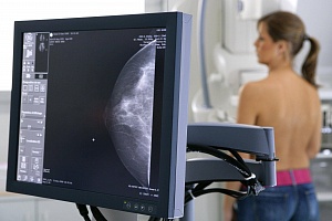Маммография